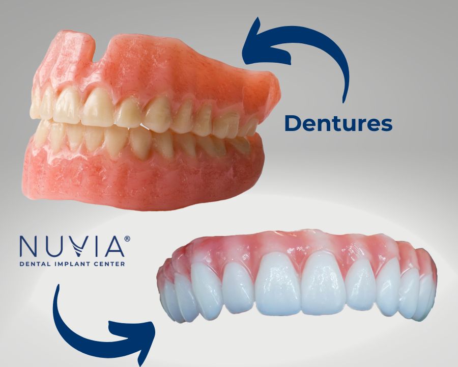Dentures with dental implant alternatives