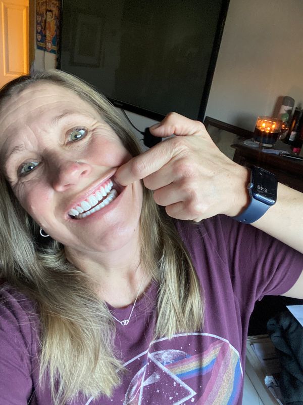 Michelle smiling after changing her life with dental implants
