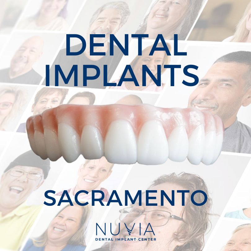 Graphic with dental implant prosthetic in Dallas
