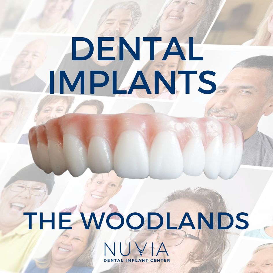 Graphic with dental implant prosthetic in Dallas