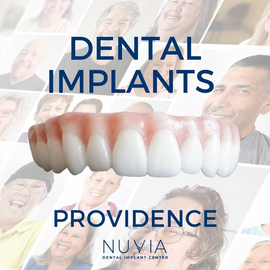 Graphic with dental implant prosthetic in Dallas