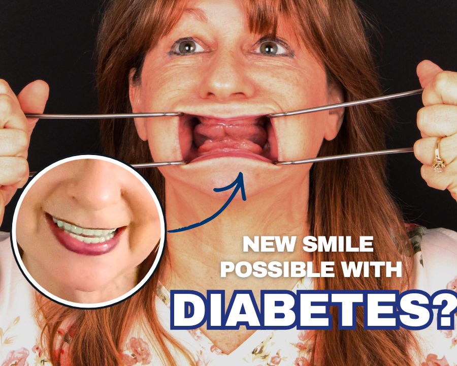 Woman pulling back lips to show missing teeth with an image of her new restored smile overlaid and text that says "new smile possible with diabetes?"